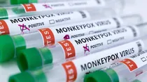 Monkeypox