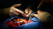 what is open heart surgery and why it is used