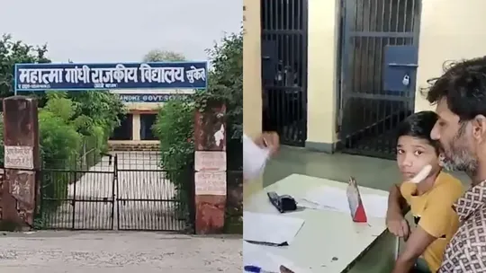 teacher slaps student in Kota Rural school his cheek severely injured