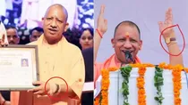 CM Yogi wrist after treatment and before treatment (photo-PTI)