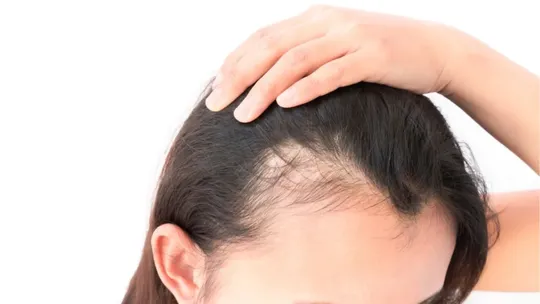 how to make fallen hair grow hair loss grow remedies