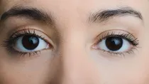 excessive eye blinking causes and treatment