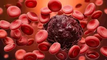 what is leukemia blood cancer its causes symptoms and treatment