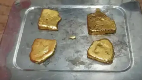 man hid one kilo gold in rectum caught at airport doctors removed through surgery jaipur abu dhabi 