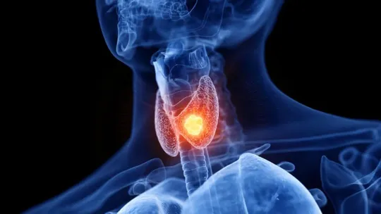 how to control thyroid hormone