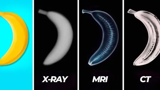 what is the difference between xray mri and ct scan