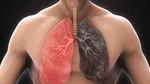 myths related to chronic obstructive pulmonary disease copd