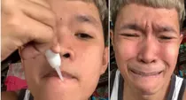 a young man stuck his own lips with super glue video viral