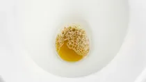 what does foam in urine indicate its causes and treatment 