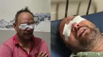 punjab-sangrur-hair-growth-medicine-side-effect-eyes-damaged-65-patients-admitted