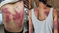 Female lawyer brutally assaulted in Beed Search of 10 accused underway