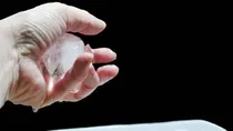 why you should not put ice on a burn sehat