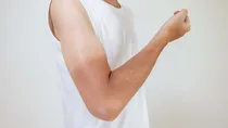 natural remedies to remove sun tan