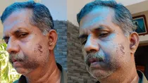 Kerala men assault his classmate broke teeth revenge