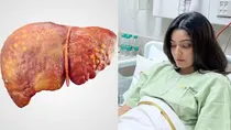 bigg boss ott season 3 sana maqbool is suffering from liver cirrhosis 