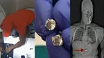 Florida thief stole diamond earrings worth Rs. 6.5 crores and swallowed them video viral