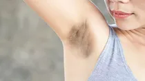 acanthosis nigricans condition can be a cause of dark underarms 