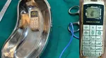 Karnataka Prisoner swallows mobile phone