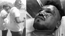 Ahmedabad Plane Crash Lone Survivor