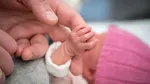 infant baby, Baby girl grows micropenis, micropenis