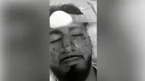 Indian Student Brutally Beaten In Australia, Accused Made Racist Comments