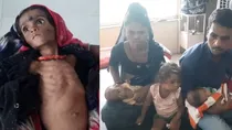 Madhya Pradesh Malnutrition