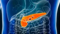 How to stop cancer from re-occurring? doctor explains  