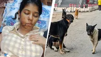 up Kanpur college student attacked by stray dog,