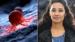 tannishtha chatterjee suffering from oligometastatic cancer know its causes symptoms and treatment