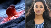 tannishtha chatterjee suffering from oligometastatic cancer know its causes symptoms and treatment
