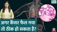 can metastatic cancer be cured sehat