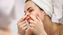 why should you not pop pimples near your nose
