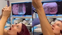 Breathtaking Video Shows Inside Of US Woman's Throat As She Swallows Sword