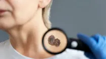 why tumor occurs in human body & how to know how to know if a tumor is cancerous