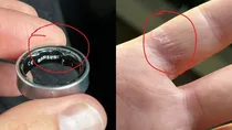 Galaxy Ring battery swollen