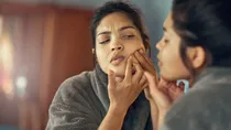 home remedies for dry oily sensitive acne prone skin