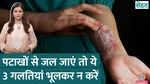 how to deal with burn injuries sehat 