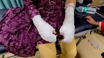 Delhi Acid Attack, Delhi Acid Attack Case, delhi university,delhi university, delhi university acid attack