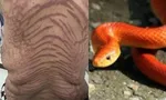 China, China News, Snake Like Skin