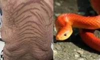 China, China News, Snake Like Skin