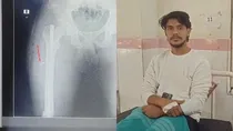 Andhra Pradesh Kakinada Tuni hospital Surgical Blade Left Inside A Young Man Leg By Doctors