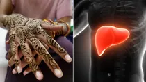 japanese scientists reveal how henna may help reverse fibrosis but does it work