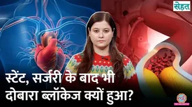 related-article-banner-image