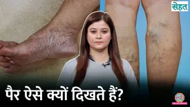 related-article-banner-image