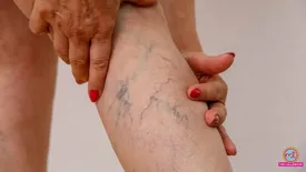 related-article-banner-image