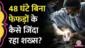 related-article-banner-image