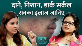 related-article-banner-image