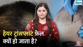 related-article-banner-image