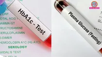 HbA1c vs Plasma Glucose Which test is more accurate for diabetes
