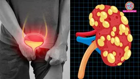 related-article-banner-image